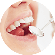 選ばれる理由4 写真